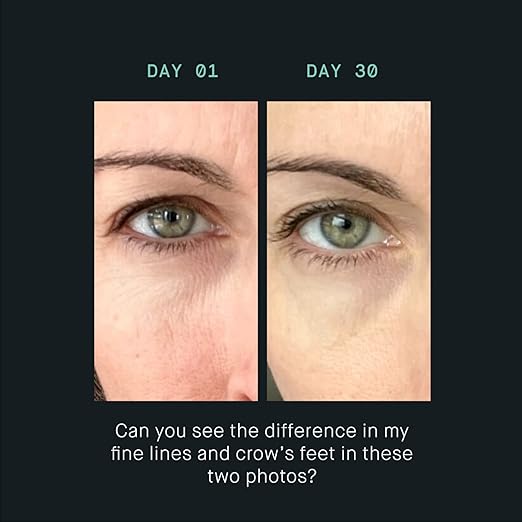 OneSkin EYE OS-01 Peptide Topical Supplement | Skin Longevity Age Reversal Eye Cream | Safe for Sensitive Skin Fragrance-Free
