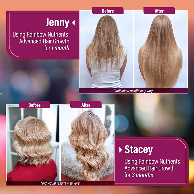 (2 Pack) Hair Growth Vitamins for Women | Biotin 10000mcg Collagen Patented OptiMSM® goMCT® Saw Palmetto | Naturally Regrow Stronger &amp Healthier Hair Skin and Nails | May Stop Hair Loss