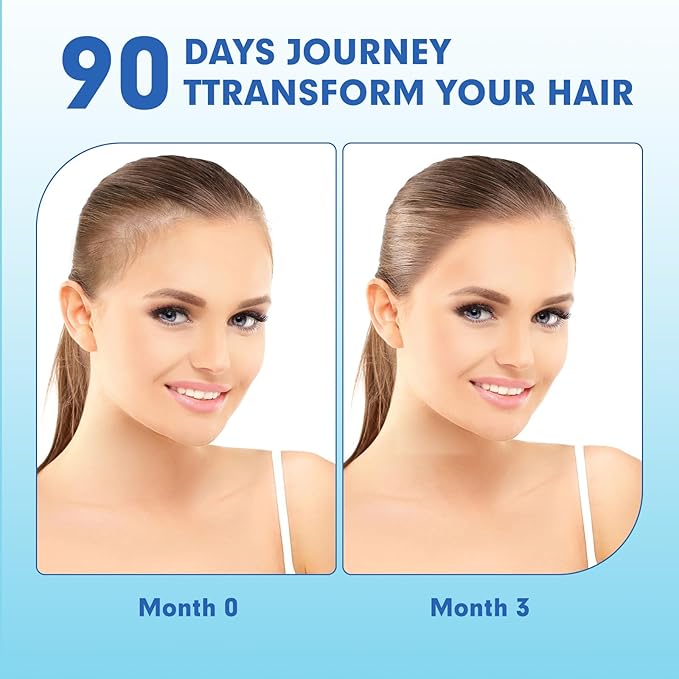 Postpartum Hair Loss Vitamin Vegan Gummies with Biotin Collagen &amp Folate Postpartum Hair Loss Products for Less Shedding Thicker Hair Stronger Hair Breastfeeding-Friendly 60 Gummies