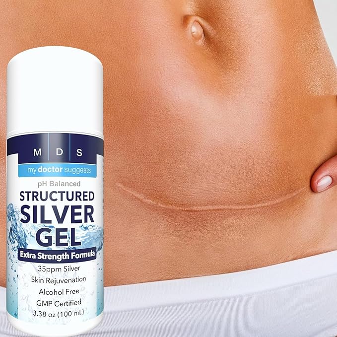Colloidal Silver Gel Extra Strength - 35ppm Activated Colloidal Silver Gel for Maximum Potency - Made in USA - Structured Formula in a Convenient 4 Pack