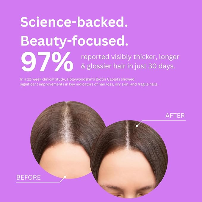 2X Stronger Hair Growth &amp Nail Strength Capsules – 10000 mcg Biotin 620 mg Collagen &amp 100mg Keratin – Thicker Fuller Hair Stronger Nails Radiant Skin – Clinically Proven in 30 Days.