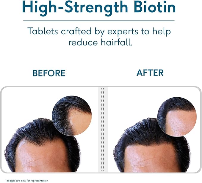 Biotin 10000mcg Supplement for Hair Growth Strong Hair and Glowing Skin Fights Nail Brittleness 90 Biotin Tablets
