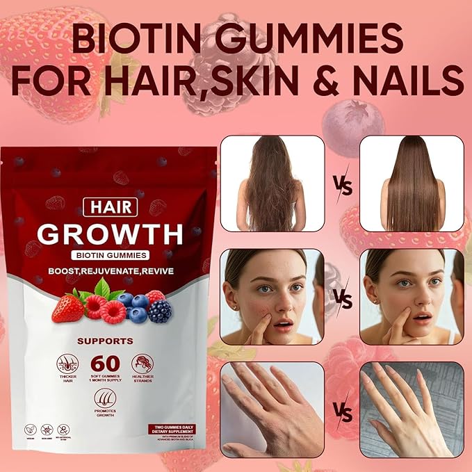Lumin Hair Growth Gummies – with Biotin Vitamin C &amp E Rosemary Saw Palmetto – Supports Healthy Hair Growth &amp Strength Skin &amp Nail Care – Mixed Berry Flavor 60 Gummies (1)