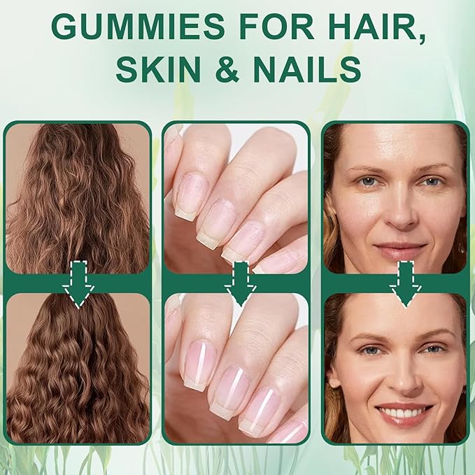 Hair Loss GummiesSea Moss Gummies with Vitamin C Vitamin E Aloe Vera Pearl Powder Support Faster Hair GrowthEnhance Nail ElasticityPromot Radiant SkinGluten-Free - 60 Count