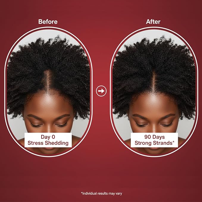 Growth Gummies for Black Women 60 Vegan Gummies Daily Hair Nourishment with Biotin Collagen &amp Botanical Extracts Supports Healthy Hair Growth &amp Strength