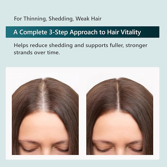 SUN COAST SCIENCES RejuvaTress from Hair Support Supplement for Women | Doctor-Formulated with Saw Palmetto Biotin &amp AnaGain Nu | Supports Thicker Stronger Healthier Hair | 60 Capsules
