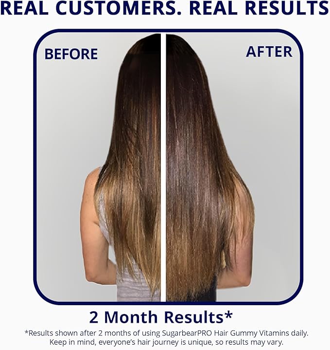 SugarBearPro Hair Vitamin Gummy 1 Month Supply Extra Strength Biotin 6000mcg for Hair Growth Vegan Vitamin B12 MSM Inositol Omega 3 Elderberry Certified Kosher Halal Cruelty-Free