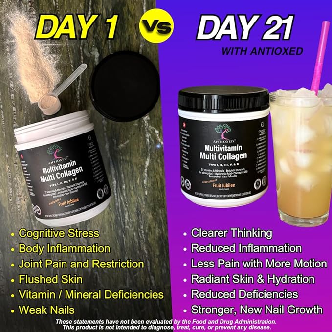 Multi Collagen Multivitamin for Women+Men Keto Skin Joint Cognitive Heart Sensual &amp Immune Health Hydrolyzed Peptides Antioxidants Probiotics No Sugar 30 Fruit Powder Servings
