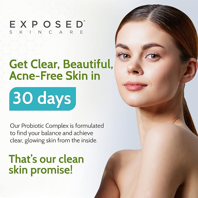 Exposed Skin Care Probiotic Supplement Complex with 1 Billion CFU – Daily Probiotic for Skin Gut and Immune Health Support – Digestive Wellness Formula for Men and Women – Non-GMO 60 Capsules