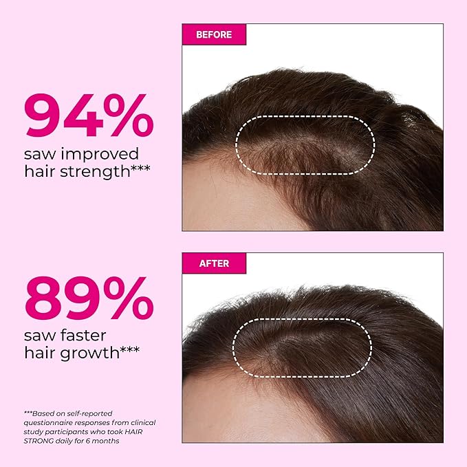 HUM Hair Strong Daily Hair Growth Gummies with Biotin Zinc Vitamin B12 to Support Growth Folic Acid &amp Vitamin B12 Gummy Vitamins for Healthy Hair Support for Women and Men 180 Gummies