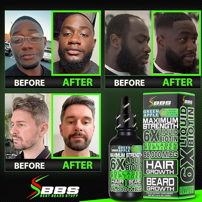 Liquid Biotin Collagen Peptides for Beard Growth and Thickening - Men's Beard and Hair Growth Supplement - Biotin Liquid Drops 96000mcg 6X More Absorption (Pack of 2)