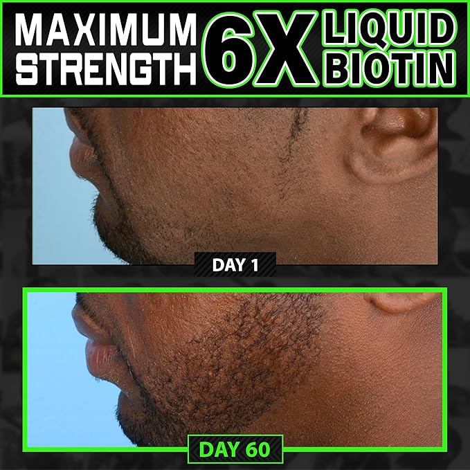 Liquid Biotin Collagen Peptides for Beard Growth and Thickening - Men's Beard and Hair Growth Supplement - Biotin Liquid Drops 96000mcg 6X More Absorption (Pack of 2)