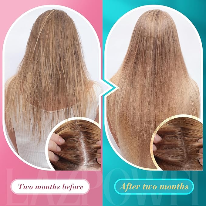 Biotin Gummies -Hair Skin and Nails Vitamins for Men &amp Women Vegan Vitamin B7 Supports Hair Growth and Stronger Nails90 Day Supply-Strawberry-180 Counts
