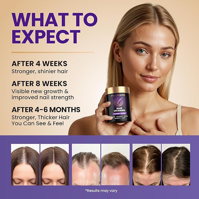 Biotin Hair Growth Supplement with Collagen Keratin and Probiotics – Hair Growth Support Skin &amp Nails Supplement for Men and Women – Supports Thicker Stronger Hair – Made in USA (3 Pack)