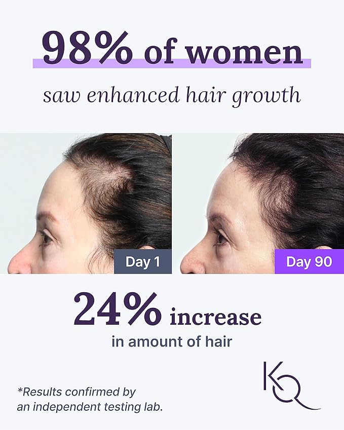Keranique Hair &amp Scalp Supplements - Promote Strength and Growth Best for Thinning Nourish Your with Biotin Vitamin B More Vital Nutrients Keraviatin