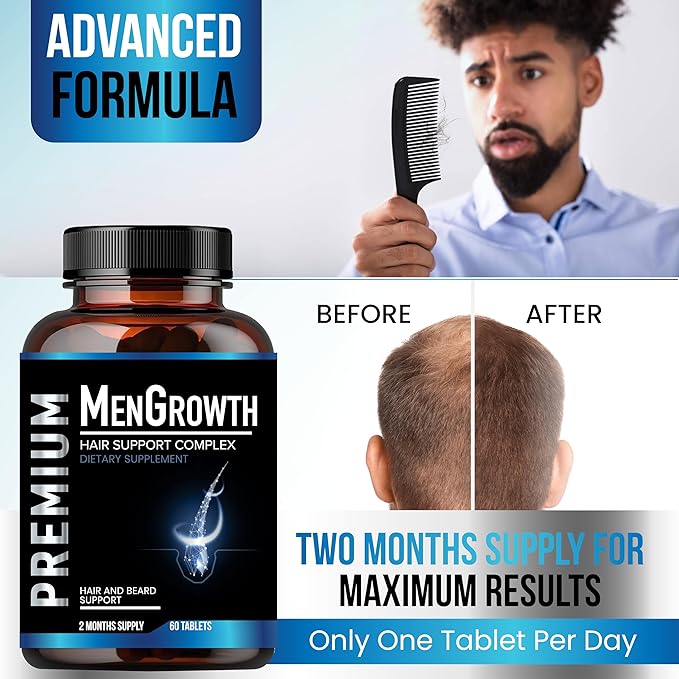 Mens Hair Growth-Hair Vitamins For Men. Anti Hair Loss Supplement Regrow Hair &amp Beard Growth Pills With DHT Blocker For Thinning Hair &amp Hair Thickening With Biotin &amp Saw Palmetto.Thicker