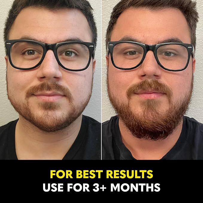 The Beard Club - Biotin Beard Growth Vitamins - Support A Thicker Fuller Beard Fill in Patches - Minerals &amp Multi-Vitamins Help Support and Stimulate Healthier Facial Hair Growth