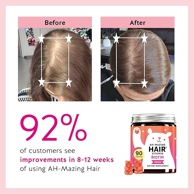 Biotin Gummies for Hair Skin &amp Nails. 5000 mcg High Potency Vegan Vitamins for Faster Hair Growth Stronger Nails &amp Healthy Skin. with Vitamins C &amp E 90 Gummies