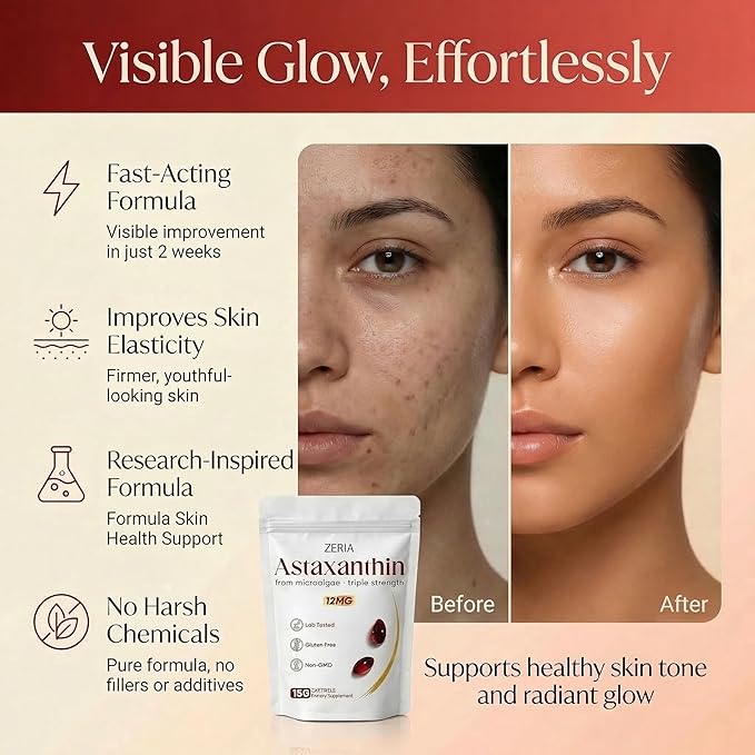 Zeria Astaxanthin 12mg Natural Microalgae Antioxidant Supplements Helps Protect Cells from Oxidative Stress Skin Firmness &amp Elasticity Promotes Healthy Skin and Eyes 150 Softgels