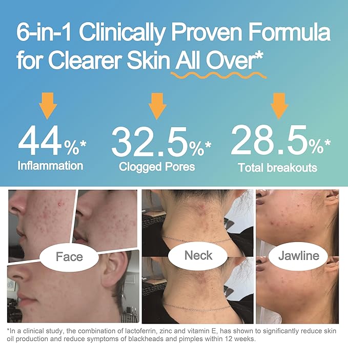 Life-Space - Probiotics for Women + Skin Probiotic Clinically Validated Support Boost Women's Health and Acne Relief + Skin Rebalance + Skin Smoother + Deep Nourishment