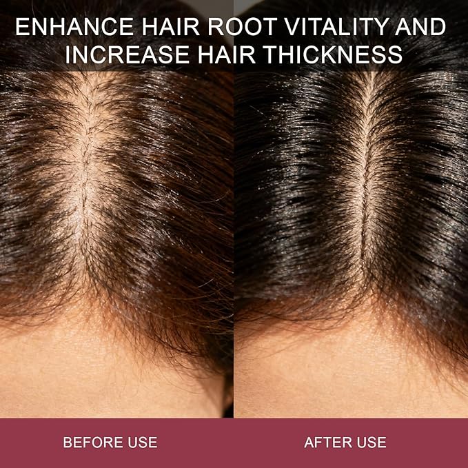 MAYLOR Hair Growth Gummies with Biotin and Collagen - Berry Flavor Daily Nutritional Supplement - Non-GMO 60 Gummies (1)
