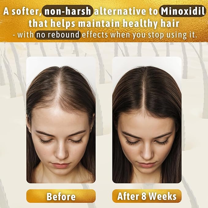 Hair Growth Serum Women &amp Men — USDA Organic Tricho10™ Natural Scalp Serum with 10 Botanical Oils for Reduced Shedding Improved Hair Density &amp Visible Hair Growth in 90 Days — All Hair Types