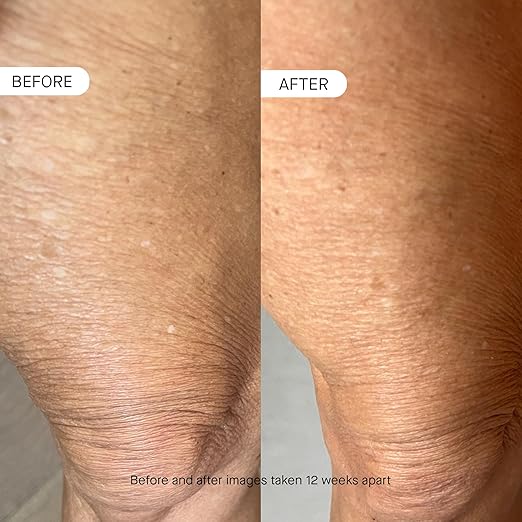 oneskin BODY OS-01 Peptide Topical Supplement &amp Skin Longevity Age Reversal Moisturizer | Safe for Sensitive Skin Fragrance-Free 250 mL / 8.45 oz