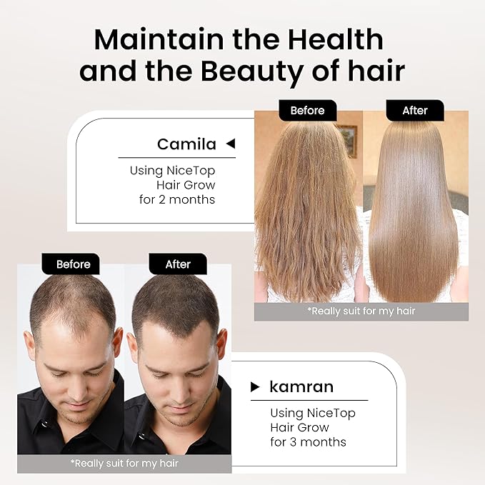 Hair Growth Supplement Hair Care Support for Strength Thickness Growth with Biotin Vitamin A C E Zinc Capsules (2)